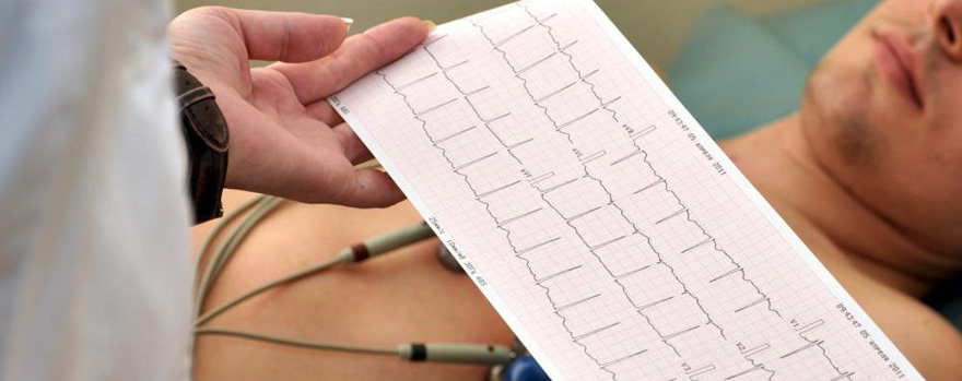 Electrocardiografía en urgencies y emergencias